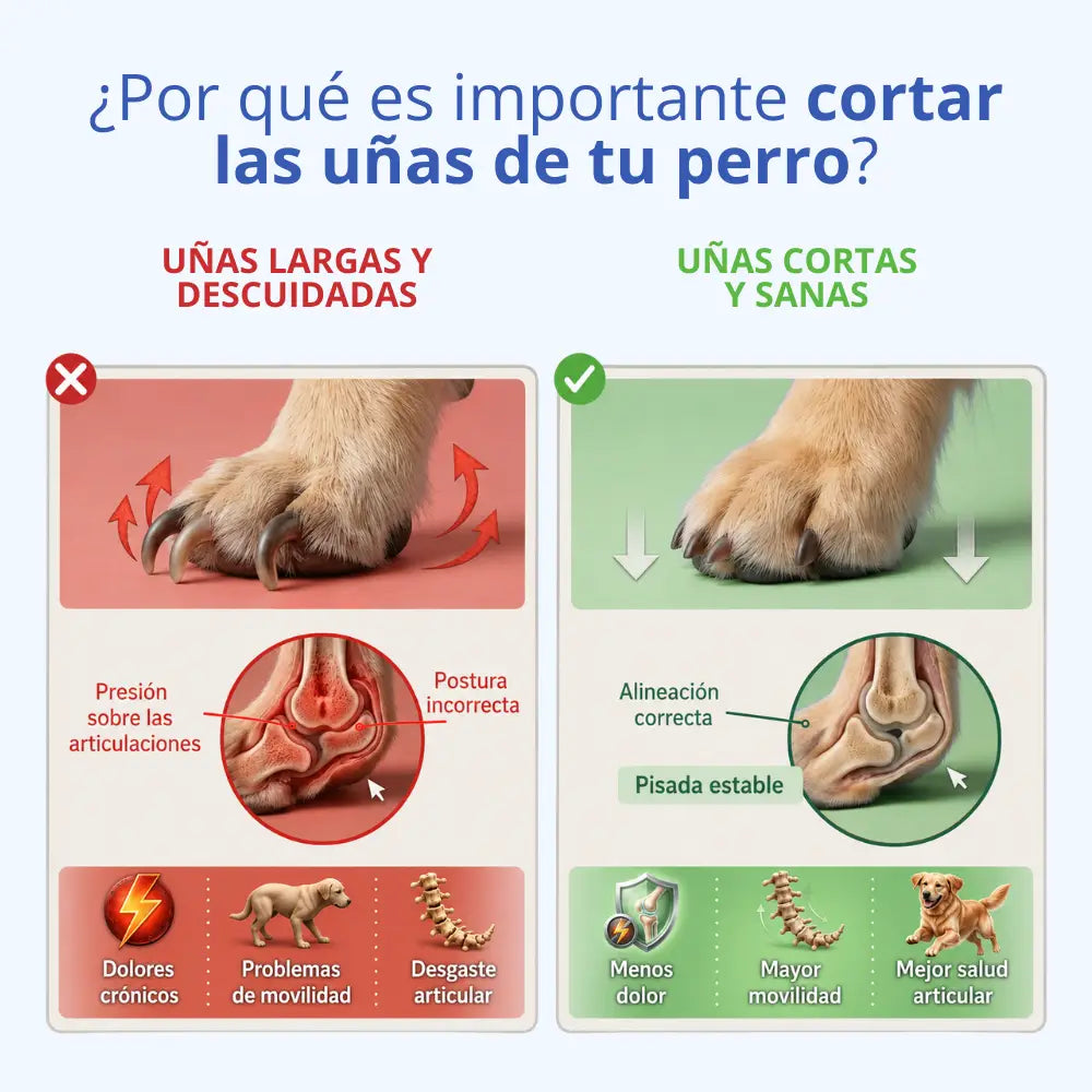 Lima de uñas silenciosa LimeGriffe™